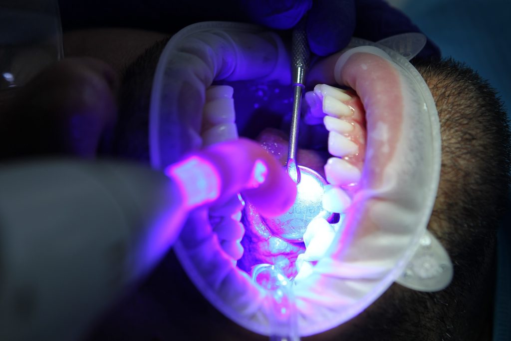 Effect on Oral Health